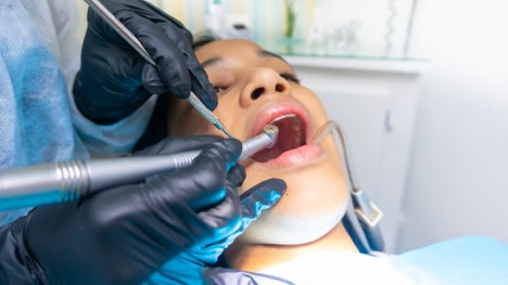 A patient has her mouth open as a dentist uses a drill on her teeth.