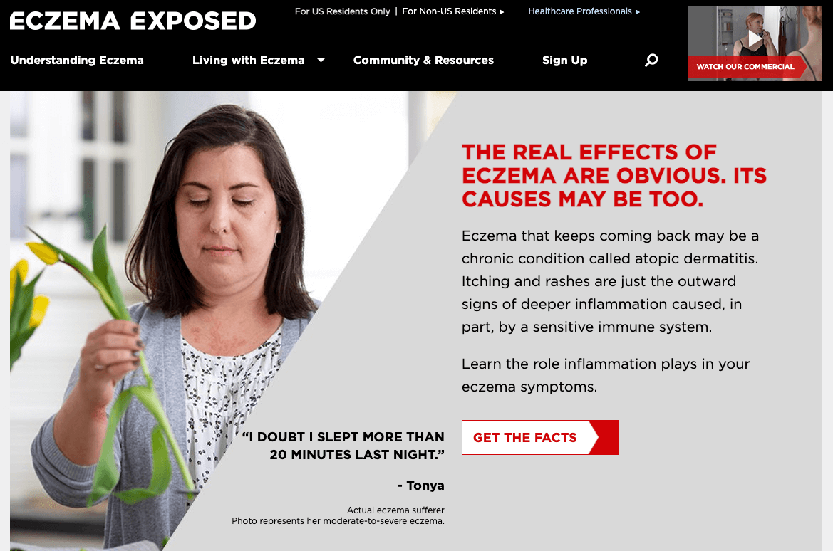 Eczema Exposed Example of great unbranded pharma website